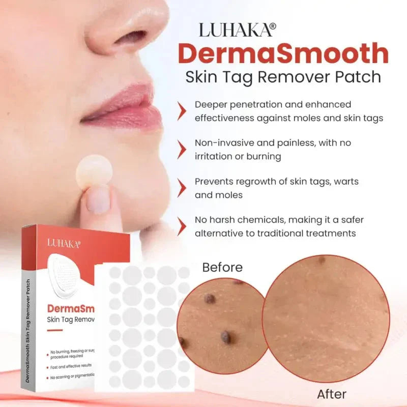 Derma Smooth Skin Tag Removal Patch -  100% Results